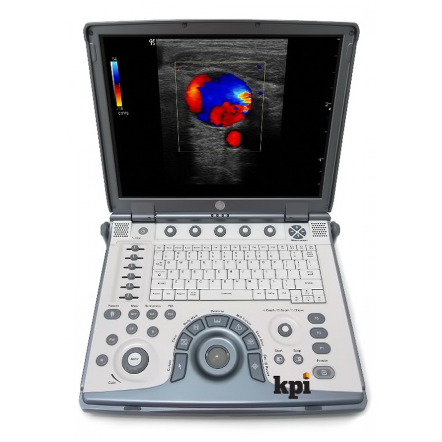 Ультразвуковой (УЗИ) сканер LOGIQ E (GE Healthcare)