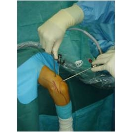 Артроскопия плечевого и локтевого суставов (Richard Wolf)