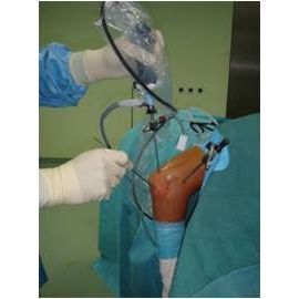 Артроскопия плечевого и локтевого суставов (Richard Wolf)