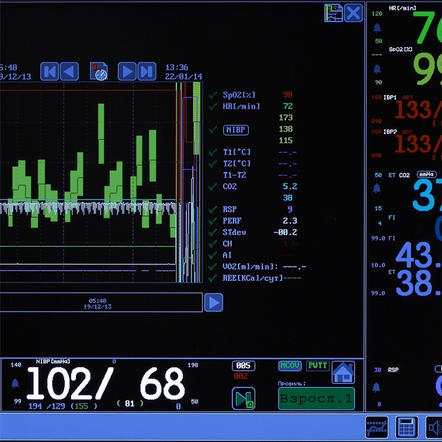 Монитор анестезиологический МПР 6-03 дисплей 15'' Комплектация А3 (Triton)