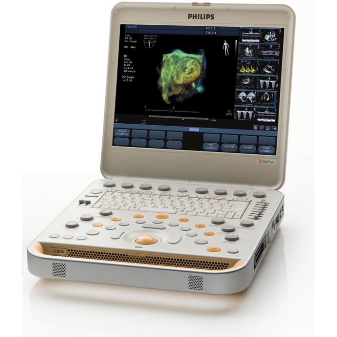 Ультразвуковая (УЗИ) система для общих исследований CX50 (Philips Healthcare)