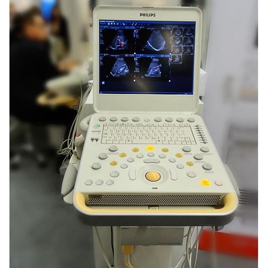 Ультразвуковая (УЗИ) система CX50 xMATRIX (Philips Healthcare)