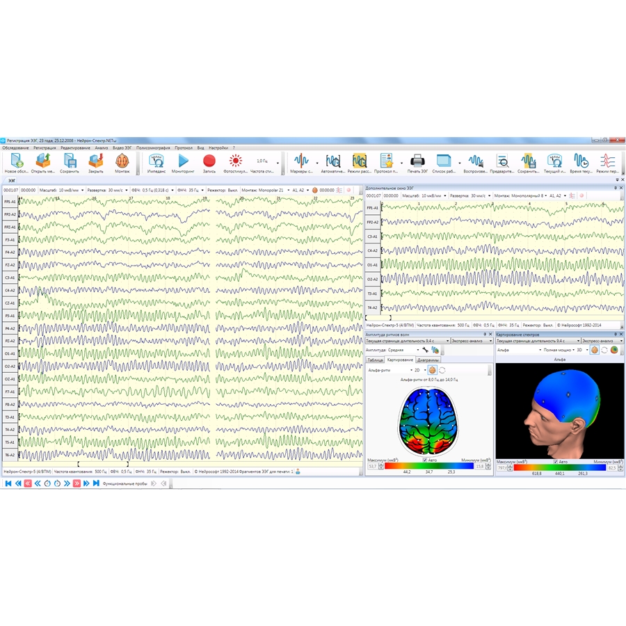 Электроэнцефалограф Нейрон-Спектр-4/ВПМ (Нейрософт)